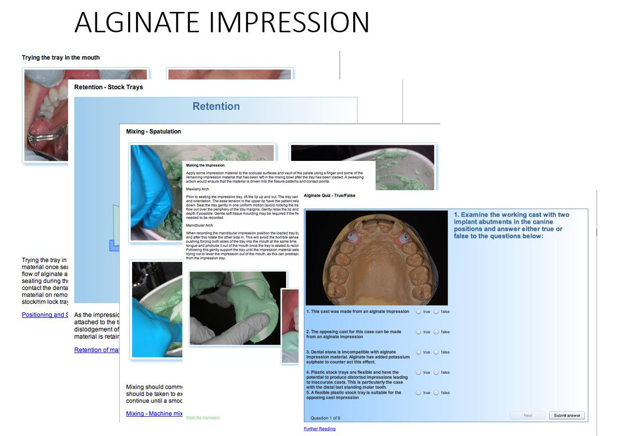 alginate